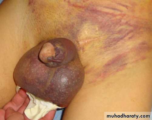 osce