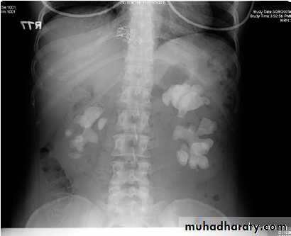 osce