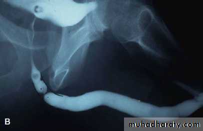 osce