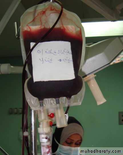 osce