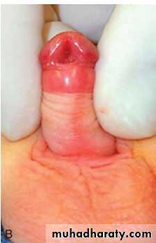osce