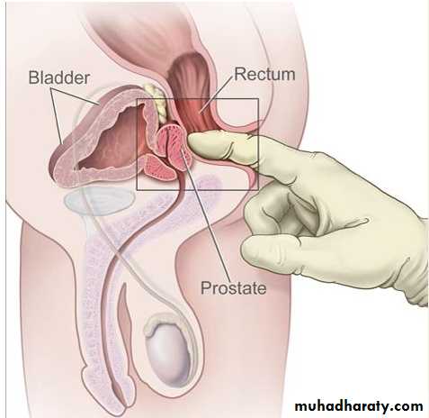 osce