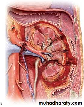 osce