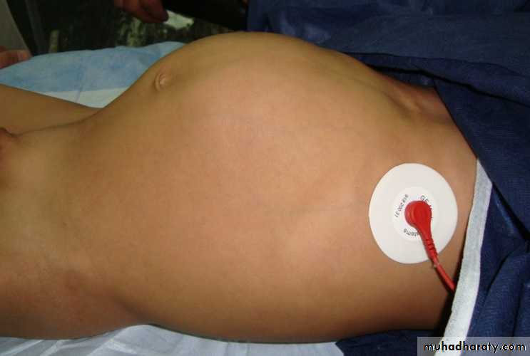 osce
