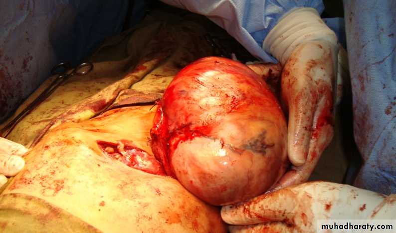 osce