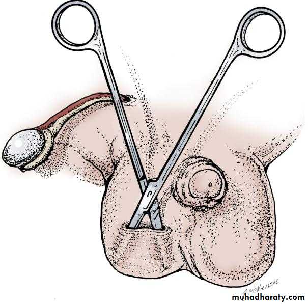 osce