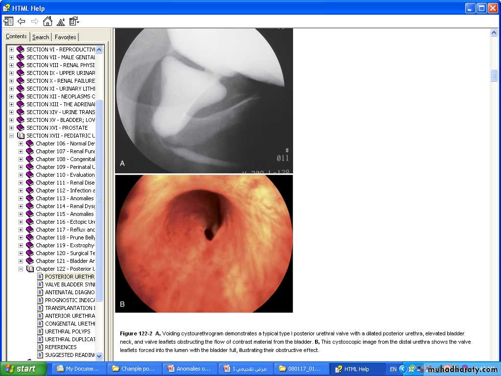 osce