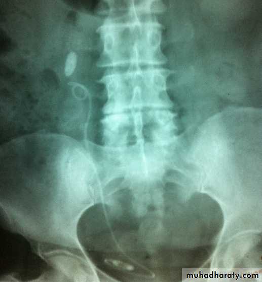 osce