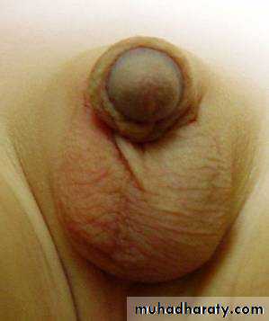 osce