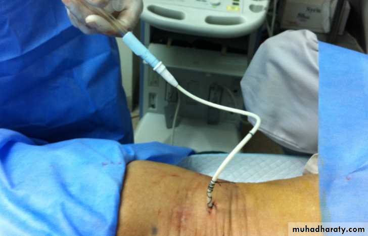 osce