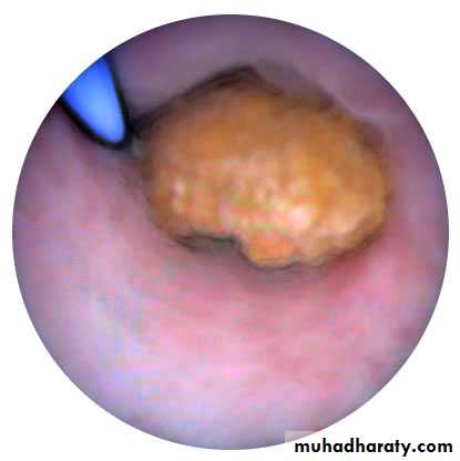 osce