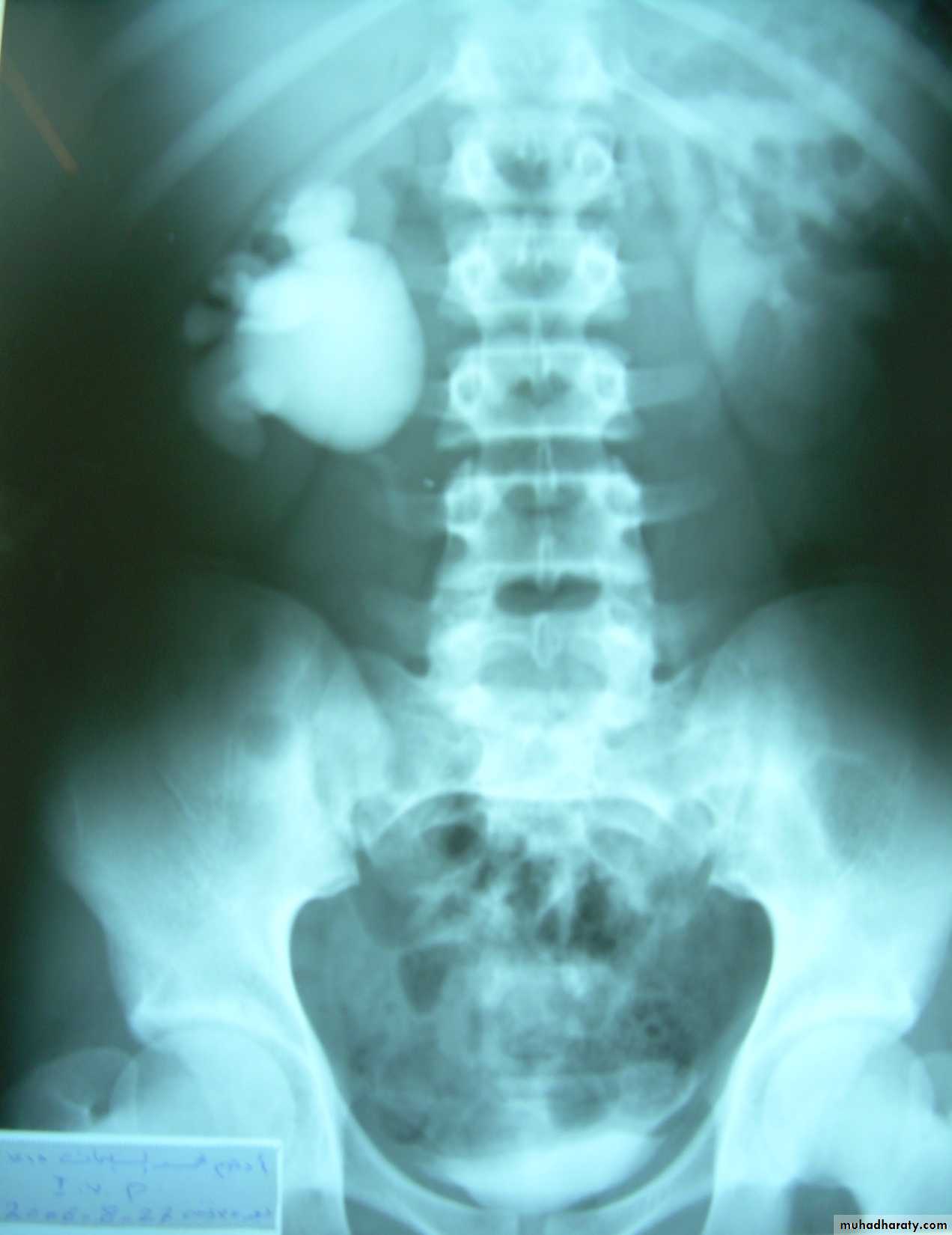 osce