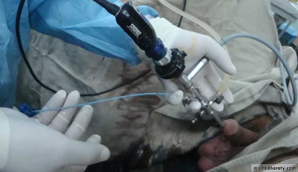 osce