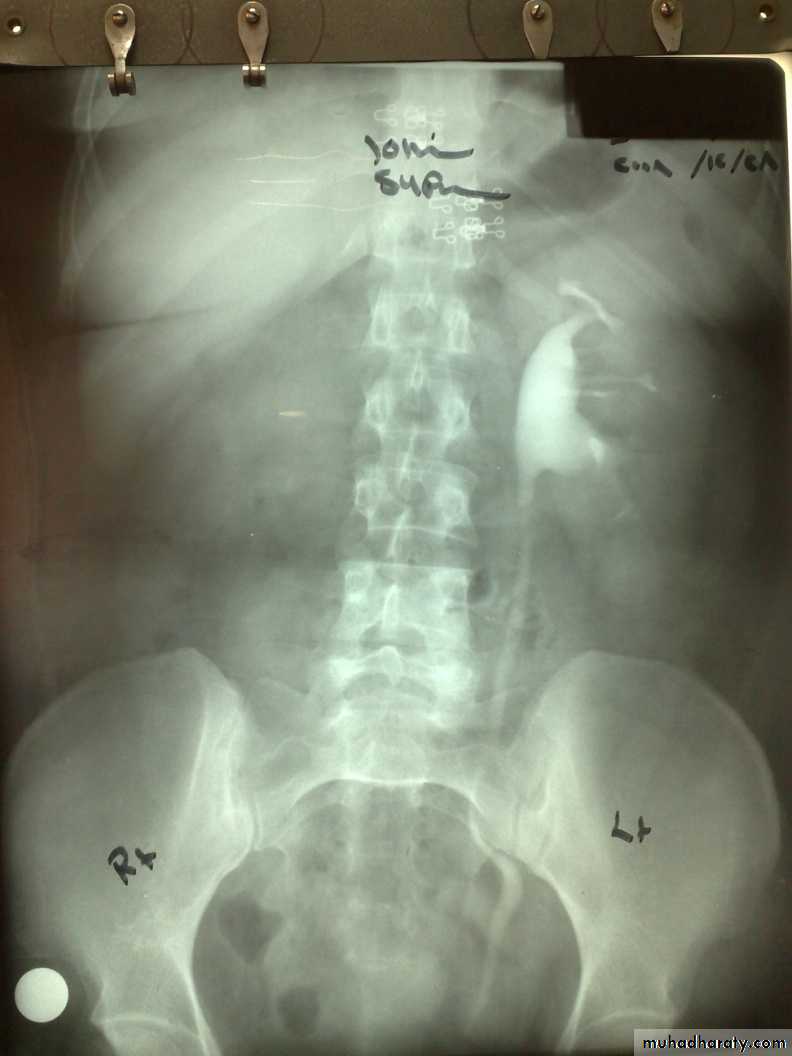 osce