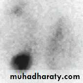 Thyroid Gland