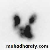 Thyroid Gland