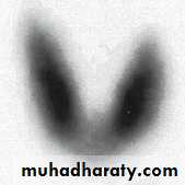 Thyroid Gland