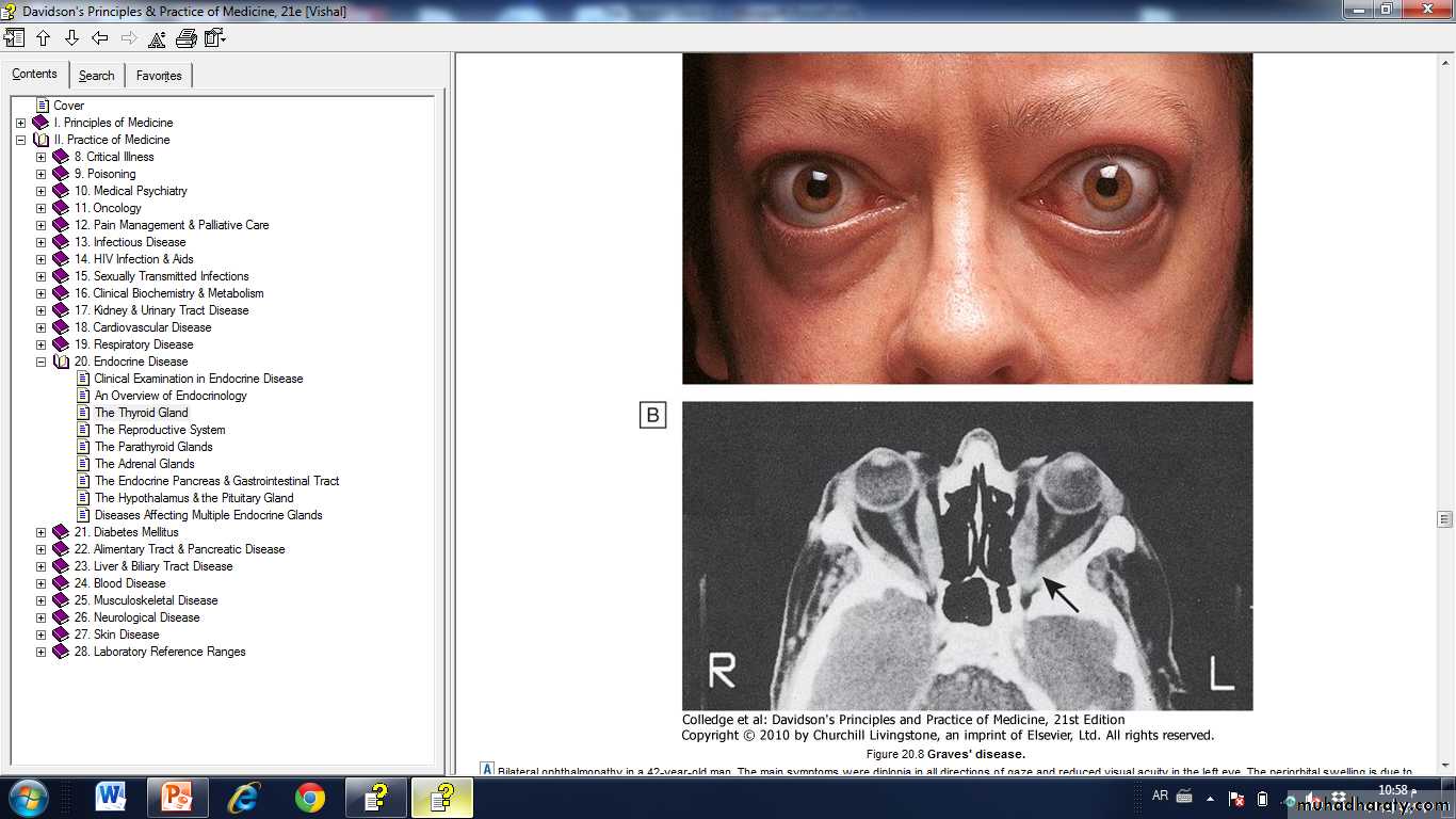 Thyroid Gland