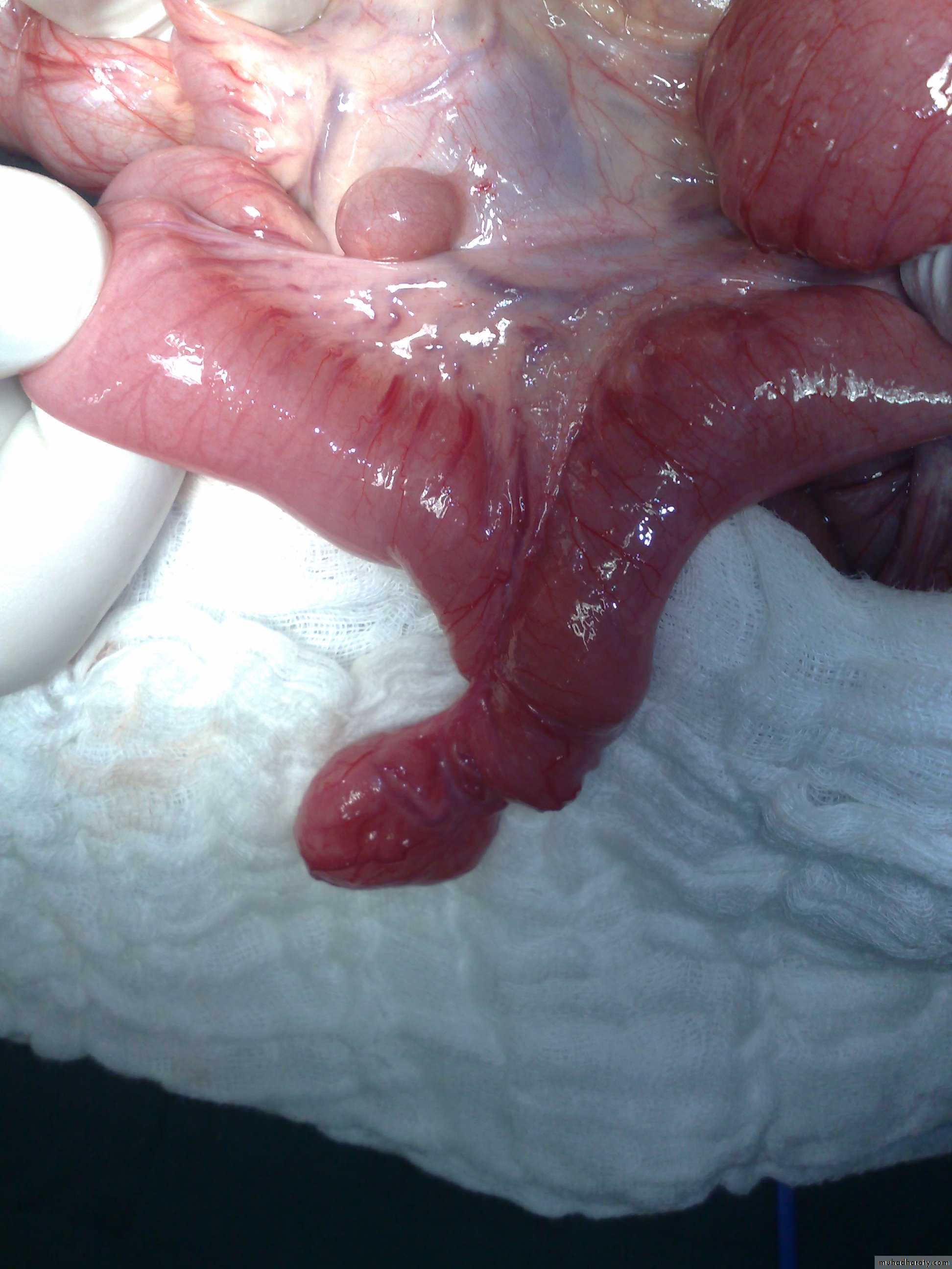 pediatric surgery