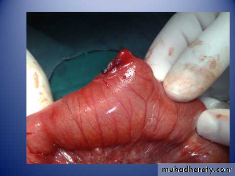 pediatric surgery