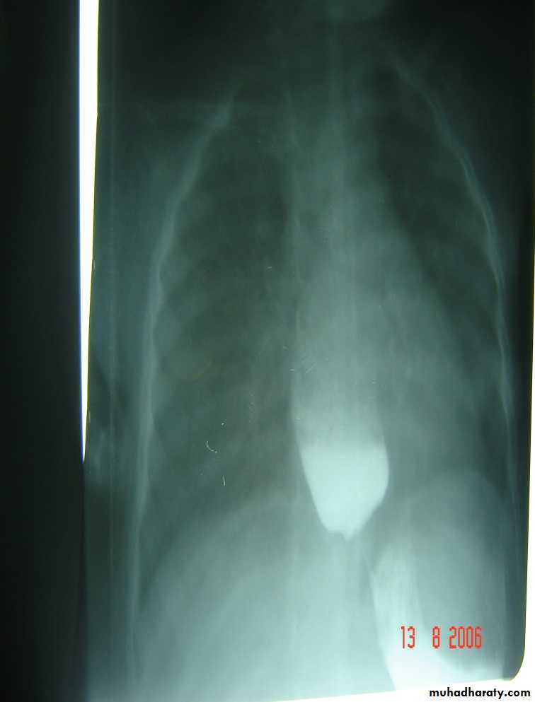 pediatric surgery