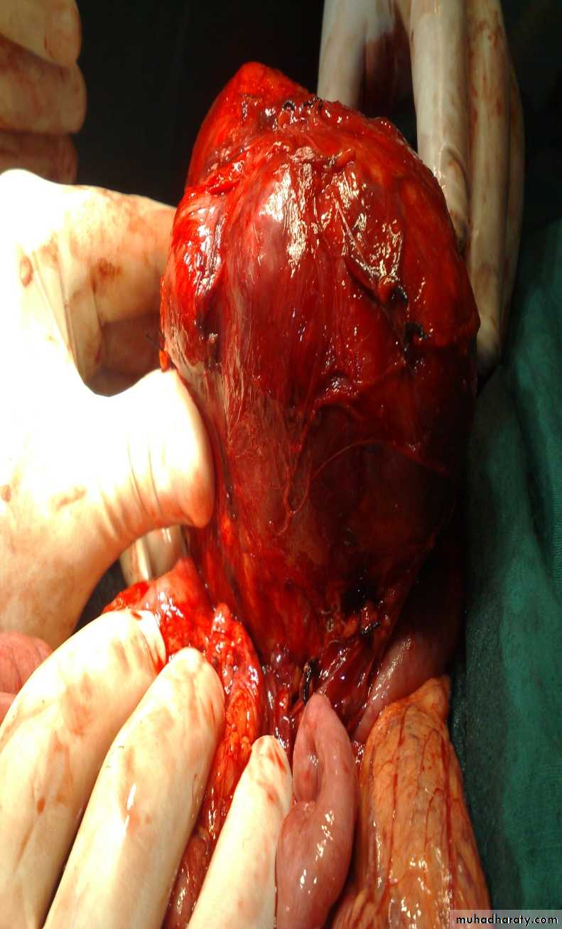 pediatric surgery