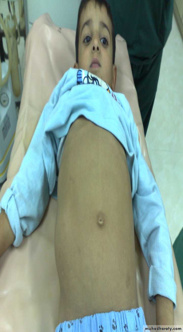 pediatric surgery