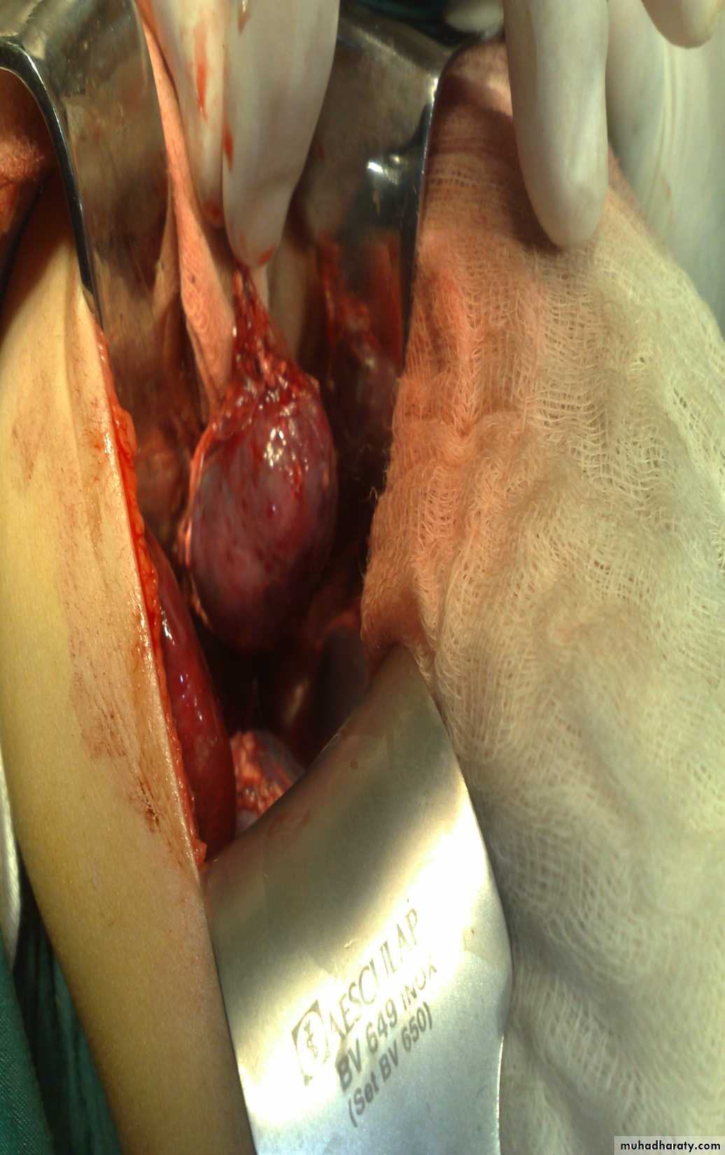 pediatric surgery