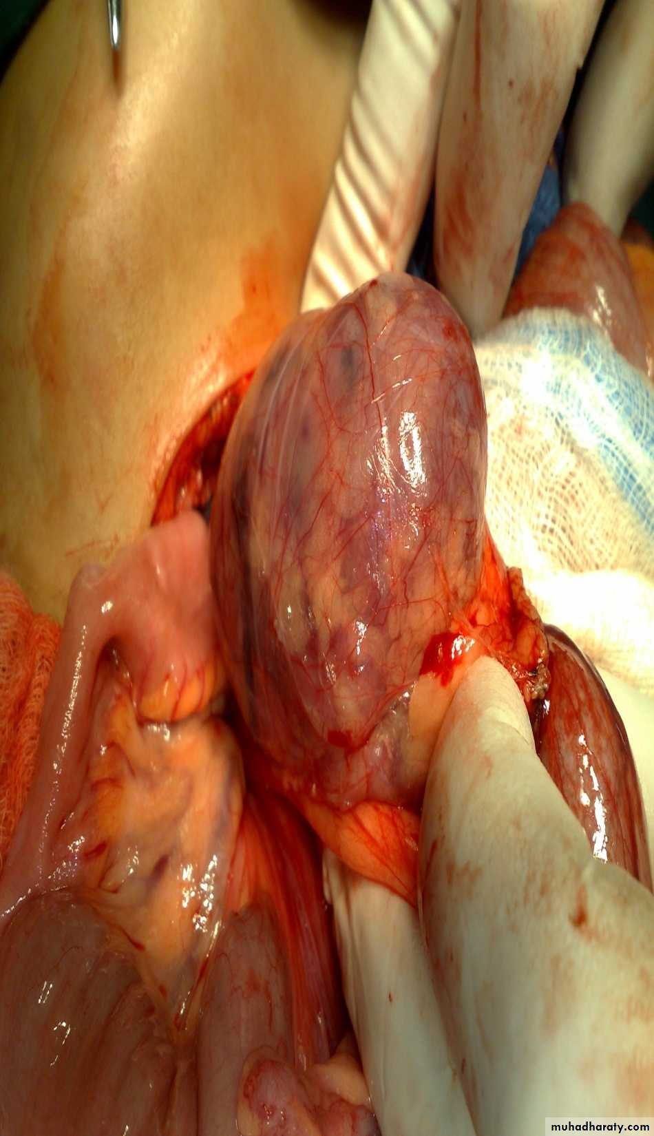 pediatric surgery