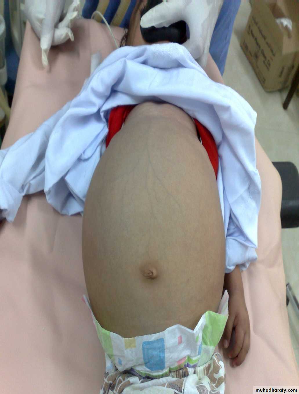 pediatric surgery