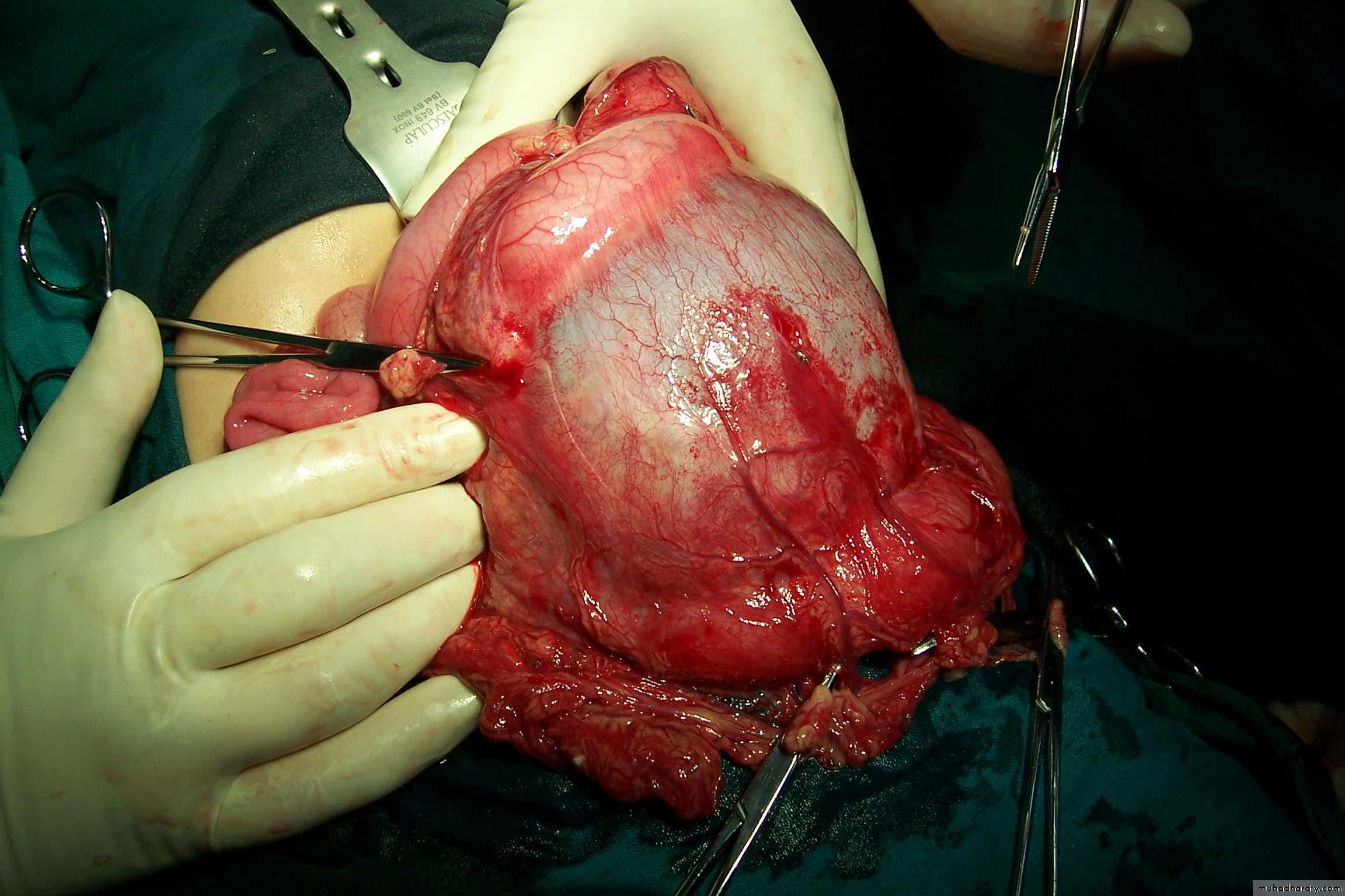 pediatric surgery