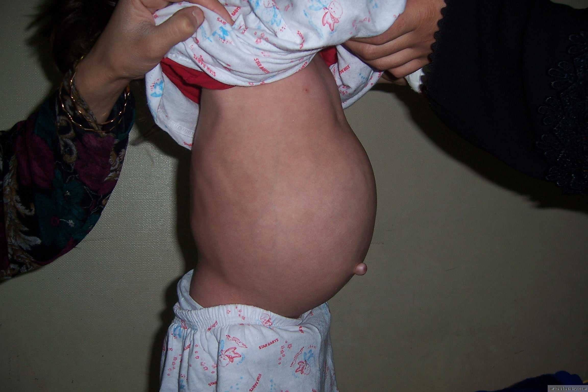 pediatric surgery