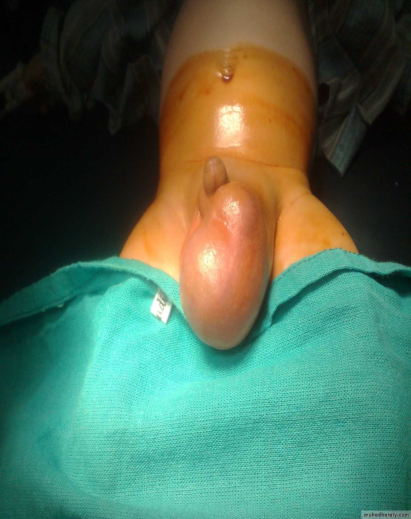 pediatric surgery