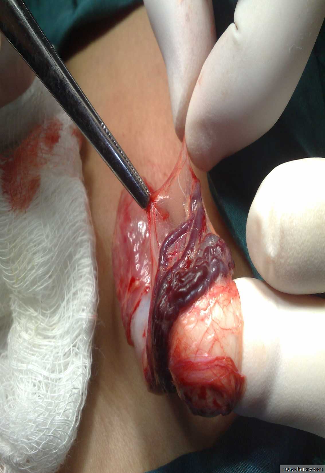 pediatric surgery