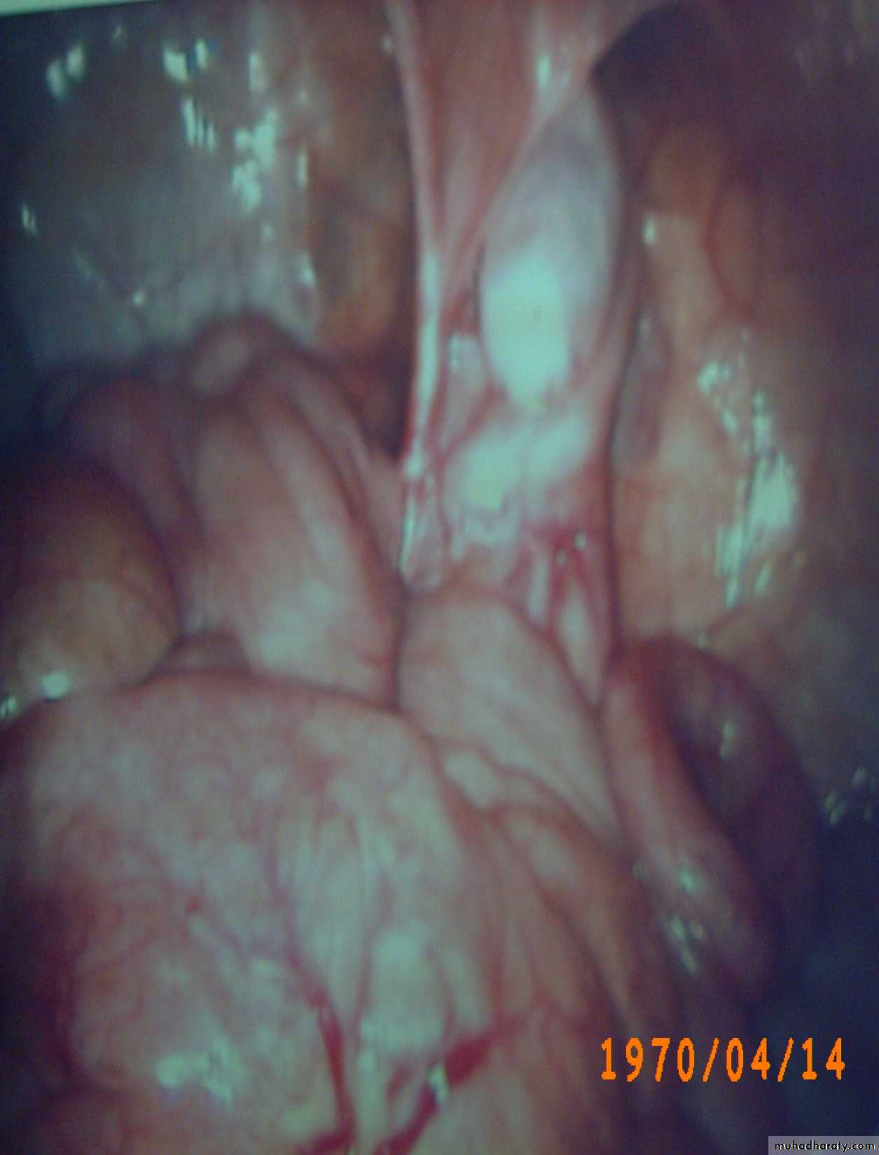 pediatric surgery