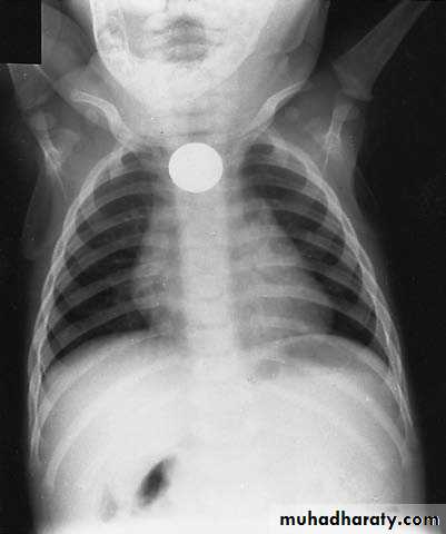 pediatric surgery