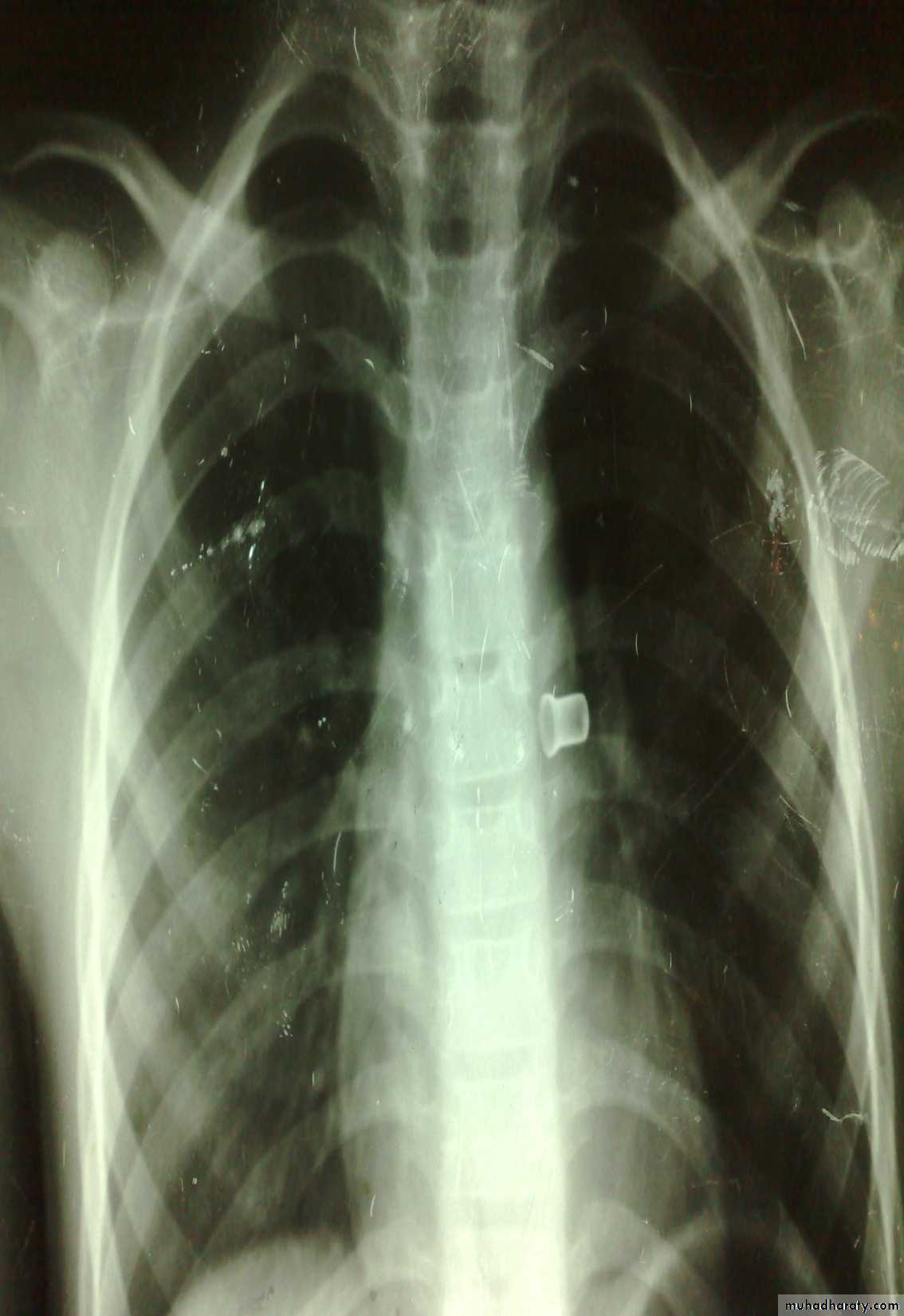 pediatric surgery