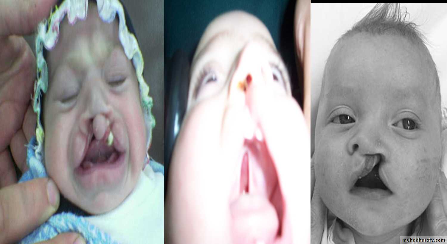 pediatric surgery