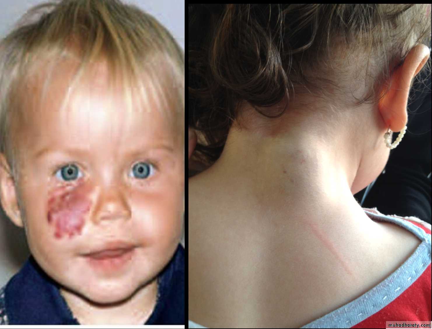 pediatric surgery