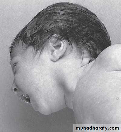 pediatric surgery