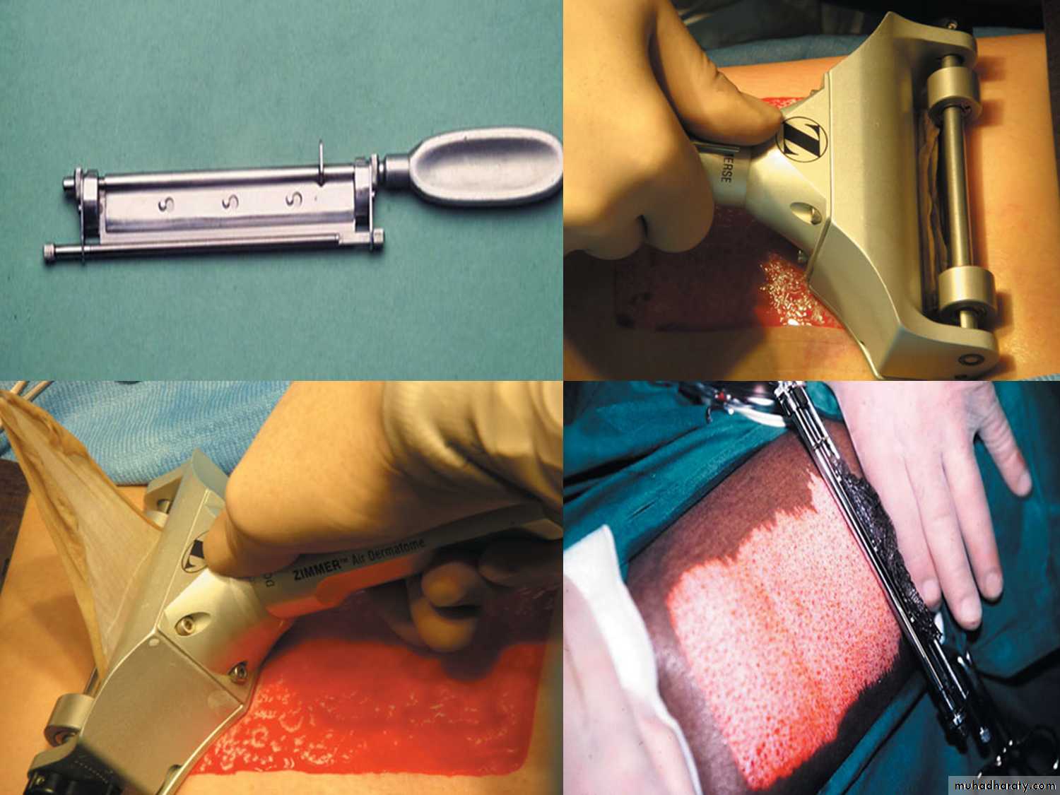 pediatric surgery
