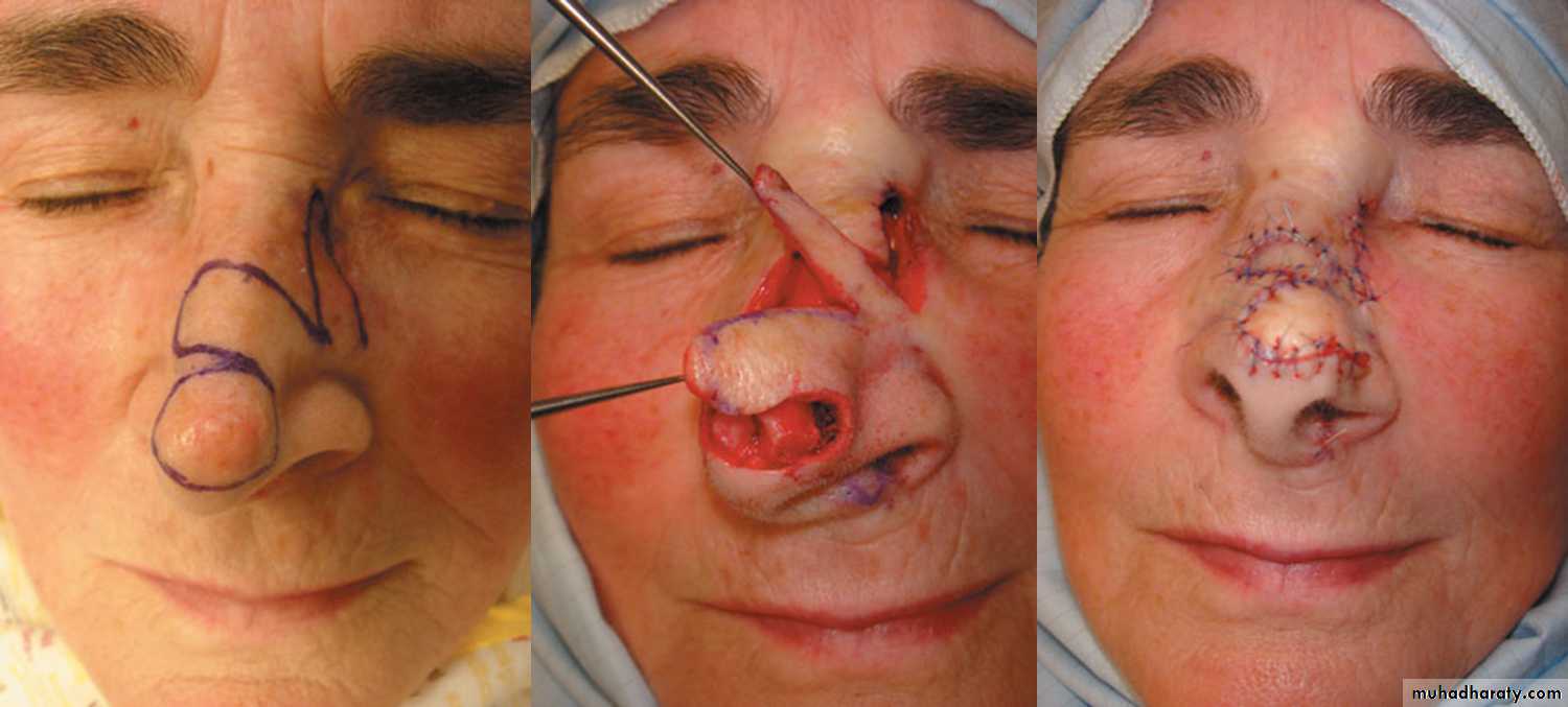 pediatric surgery