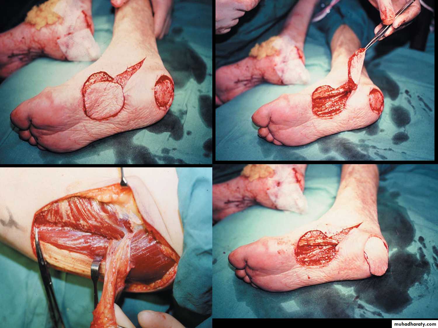 pediatric surgery