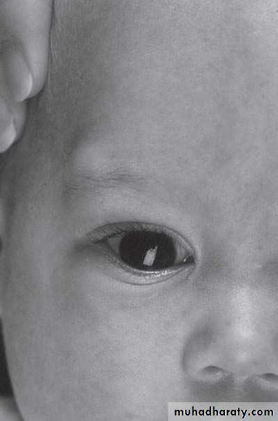pediatric surgery