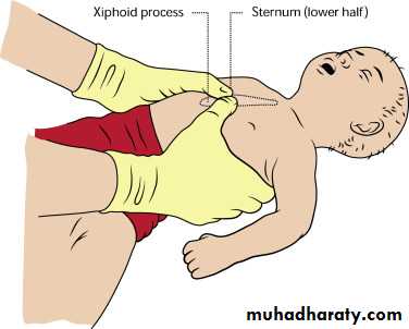 Neonatal Emergency