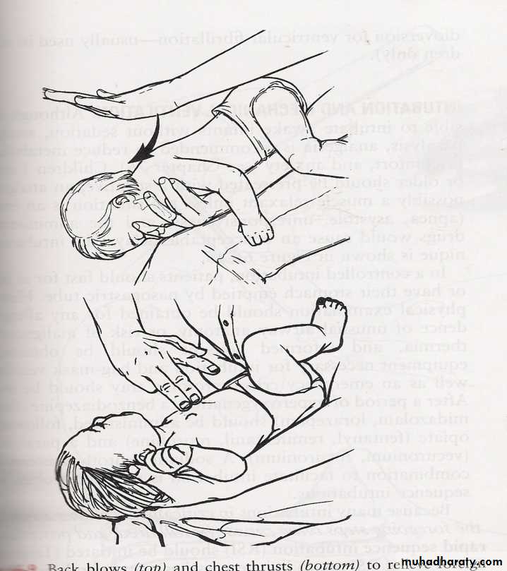 Neonatal Emergency