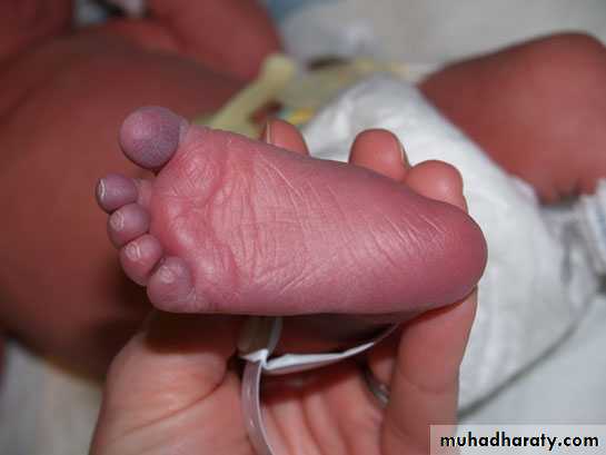 neonatal exam