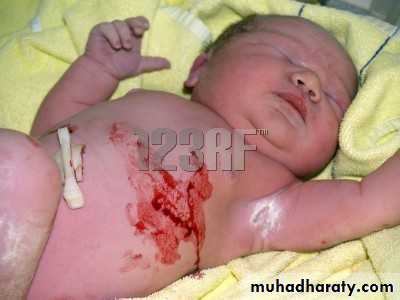 neonatal exam