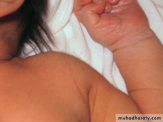 neonatal exam