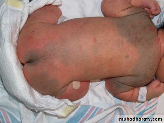 neonatal exam